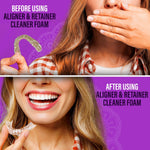 Split before-and-after style image showing a woman covering her mouth with an aligner and a smiling woman holding a clean aligner, labeled 'Before using' and 'After using'.