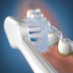 Illustration of a toothbrush head brushing teeth with cleaning particles and bristles contacting tooth surfaces.