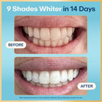 Before-and-after close-up photos of a smile showing visibly whiter teeth with Lumineux results claim