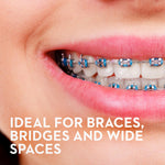 Close crop of a smiling mouth wearing metal braces, showing teeth and brackets with product claim text overlay.
