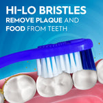 Illustration of an Oral-B toothbrush brushing molars highlighting hi-lo bristles removing plaque and food