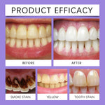 Before-and-after dental photo comparison and three smaller images showing smoke stain, yellow and tooth stain examples under 'Product Efficacy'